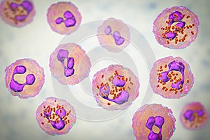 Meningococcal meningitis, cerebrospinal fluid smear photo