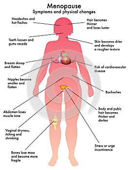 Menopausia 