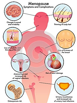 Menopause photo