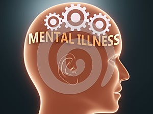 Mental illness inside human mind - pictured as word Mental illness inside a head with cogwheels to symbolize that Mental illness
