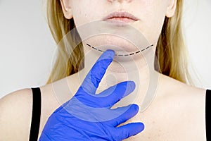 Mentoplasty: plastic chin. Patient before chin and neck surgery. Plastic surgeon advises photo