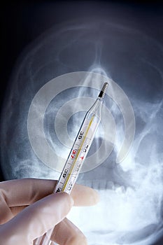 Mercurial thermometer and x-ray of head in hand with medical sterile rubber glove