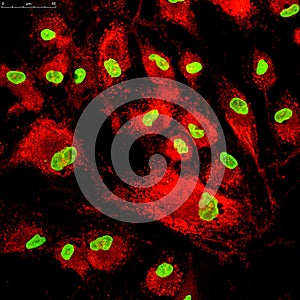 Mesenchymal stem cells