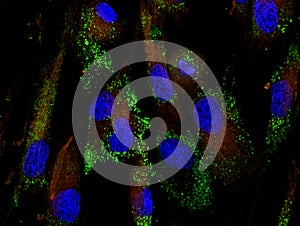 Mesenchymal stem cells labeled with fluorescent mo photo