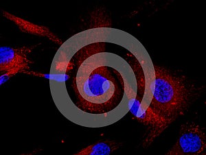 Mesenchymal stem cells labeled with fluorescent mo photo