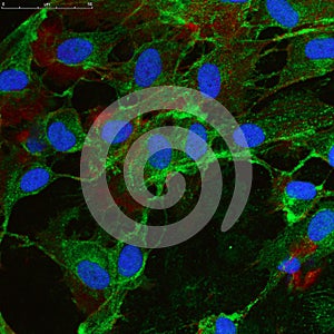 Mesenchymal stem cells photo