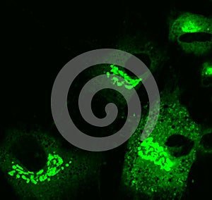 Mesenchymal stem cells