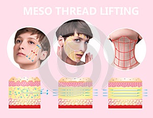 Meso thread Lift. Young female with clean fresh skin.