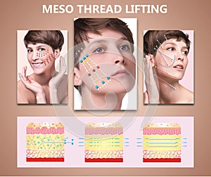 Meso thread Lift. Young female with clean fresh skin. Beautiful woman. face and neck. photo