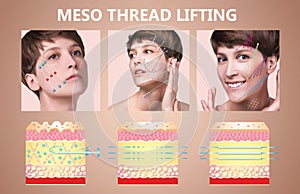 Meso thread Lift. Young female with clean fresh skin. Beautiful woman. face and neck. photo