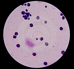 Mesothelial cells