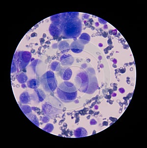 Mesothelial cells