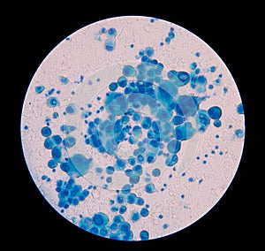 Mesothelial cells