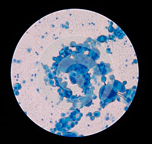 Mesothelial cells