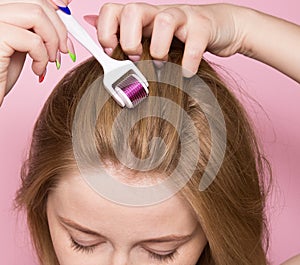 Mesotherapy for hair using a mesoroller. Care for the scalp, hair growth, against hair loss. A woman with a mesopen on her hair on