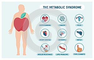 The metabolic sundrome