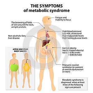 Metabolic syndrome