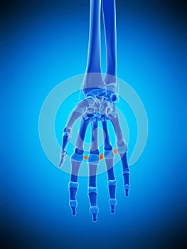 The metacarpal ligaments