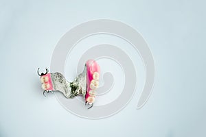 Metal denture. arch prosthetics. false teeth. Clammer upper removable denture. concept of dental prosthetics. light background