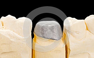 Metal framework crown