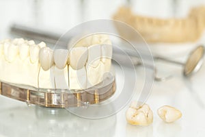 Metal free ceramic dental crowns