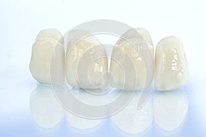 Metal free ceramic dental crowns photo