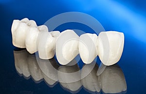 Metal free ceramic dental crowns photo