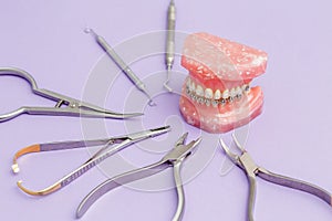 Metall wire dental braces on teeth orthodontic model