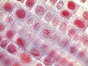 Metaphase of an onion root tip cell under the microscope