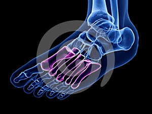 The metatarsal bone