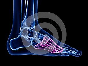 the metatarsal bone