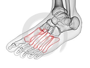 The metatarsal bone