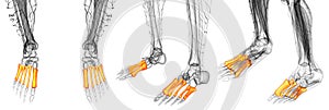 Metatarsal bones