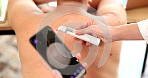 Method of dermatoscopy of skin formations and moles digital dermatoscope