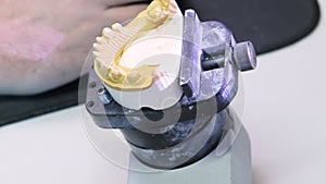 A meticulous 3D scanning process of a dental prosthesis at a specialized lab