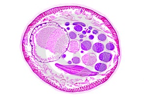 Micro photography of earthworm cross section