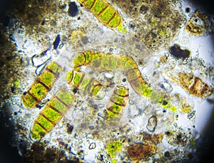 Microalgae under a microscope