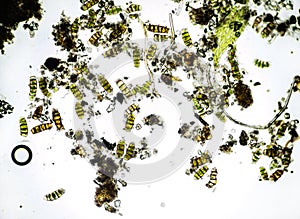 Microalgae under a microscope