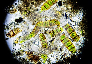 Microalgae under a microscope