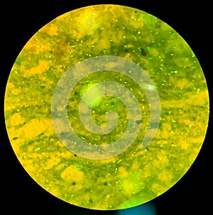 Microbacterium Tuberculosis Bacteria (MTB).