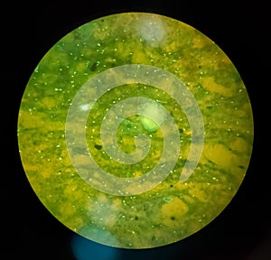 Microbacterium Tuberculosis Bacteria (MTB).