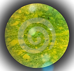 Microbacterium Tuberculosis Bacteria (MTB).