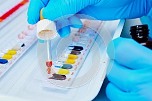 Microbiological laboratory. Mold and fungal cultures. Bacterial research.