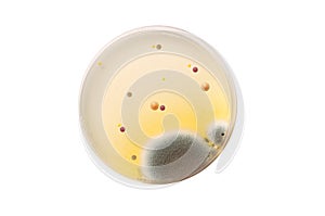 Microbiological plate with bacteria and fungi