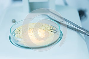 Microbiological Testing for Food