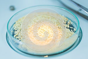 Microbiological Testing for Food Quality