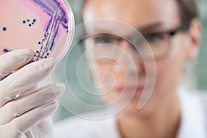Microbiologist holding a Petri dish with bacteria photo
