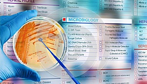 Microbiologist holding petri dish with Streptococcus agalactiae bacterial colonies on a digital microbiology test request form