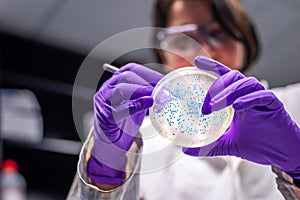 Doctor examining meningococcal bacterial culture plate photo