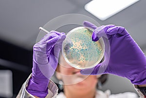 Doctor examining meningococcal bacterial culture plate